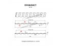 Профлист Металл Профиль МП-20x1100-R (PURETAN-20-RR23-0,5)